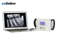 Προφορική ιατρική μονάδα ακτίνας X 20KHz LCD 7800mAh 80W οδοντική